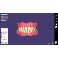 Exocad Full Denture Module - модуль для создания полносъемных протезов | Exocad (Германия)